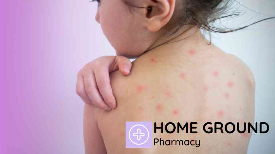 Get the Chickenpox Vaccine in Swindon