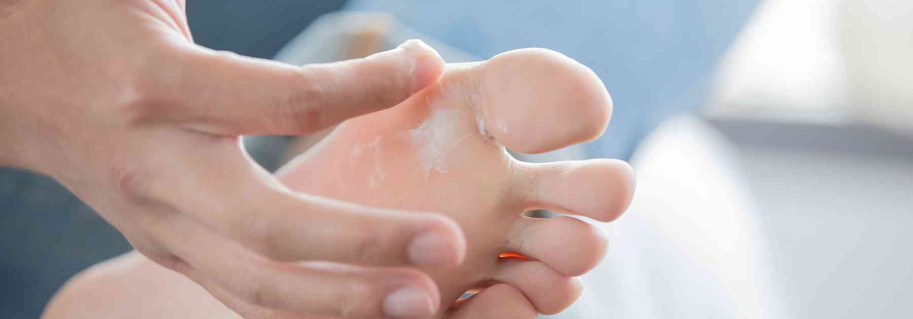 athlete's foot cream near me