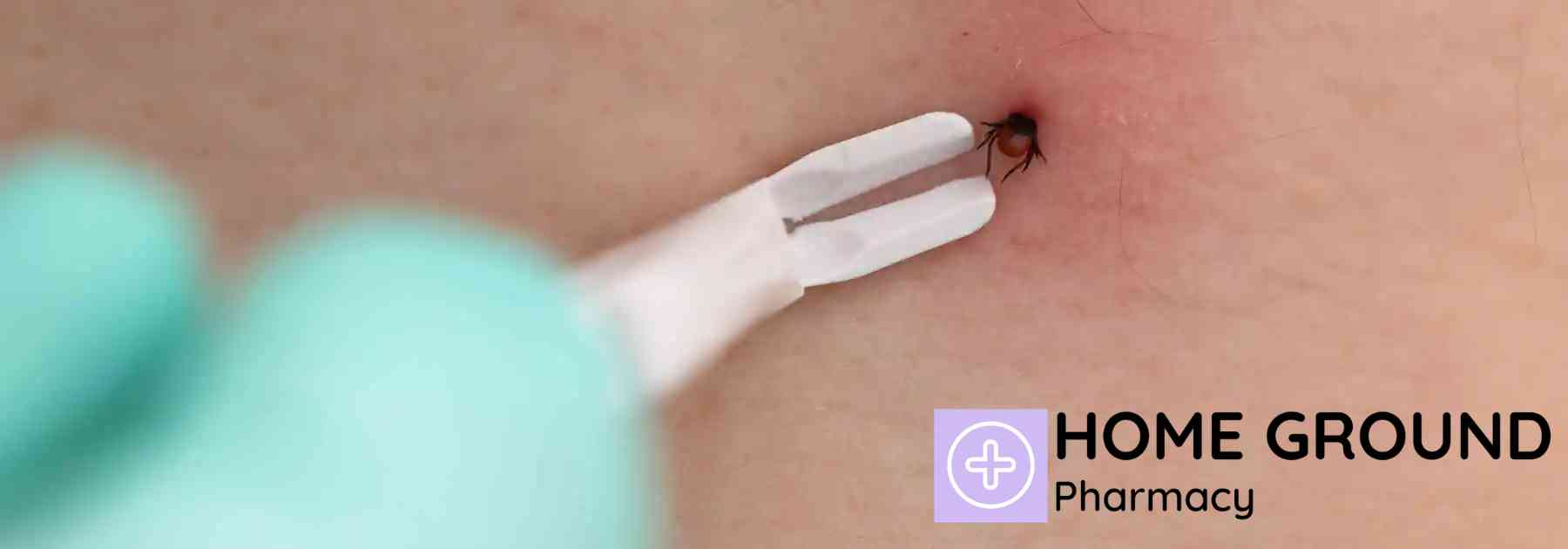 person wearing medical glove using white tick removal tool