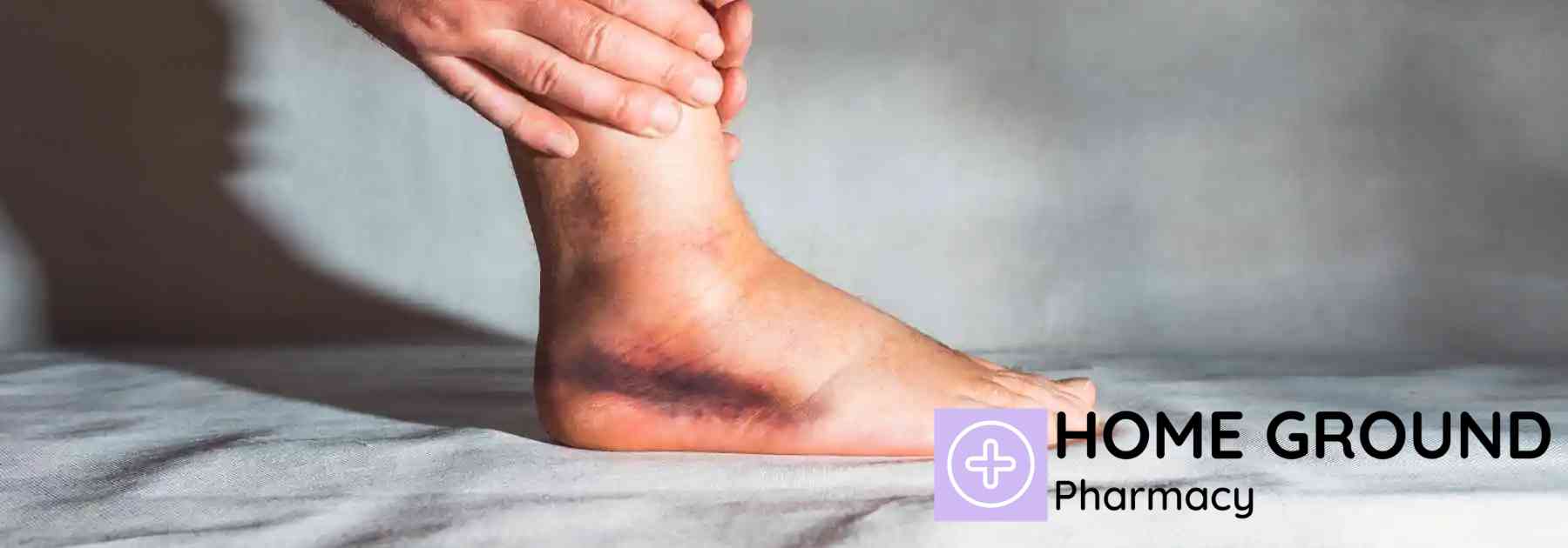 close-up of sprained ankle