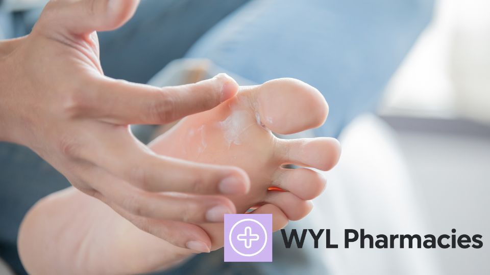 How to Treat Athlete’s Foot with Guidance from Our Swindon Pharmacy